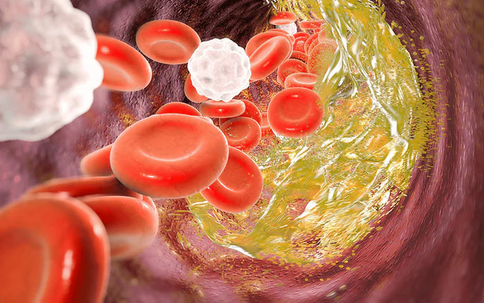 LDL-kolesteroli: Kaikki mitä sinun tulee tietää