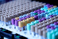 Kaikki mitä sinun tulee tietää