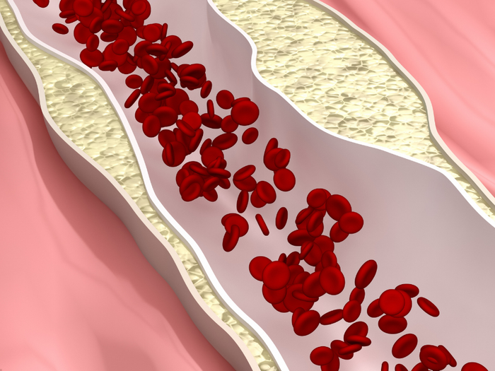 Triglyseridit – kattava opas